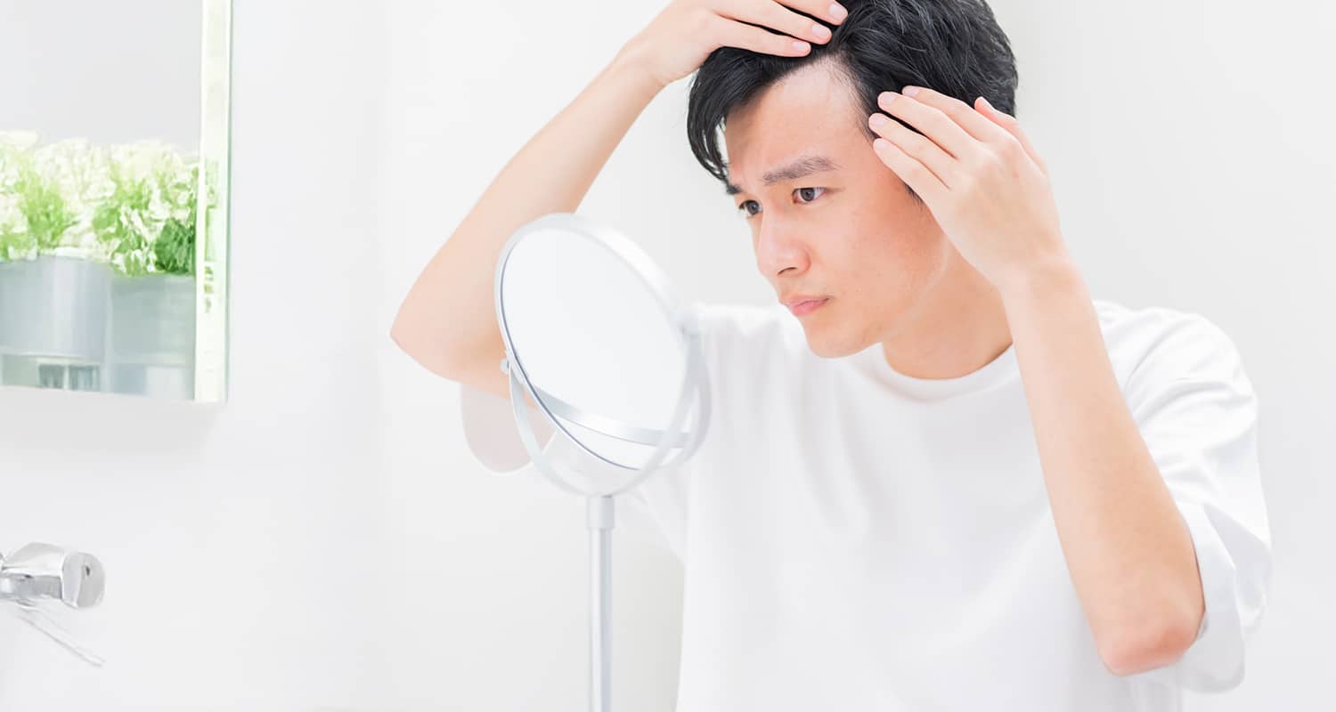 【AGA】薄毛の悩みを解決！効果的な治療薬とオンライン診療の活用美容薬局®︎オンライン