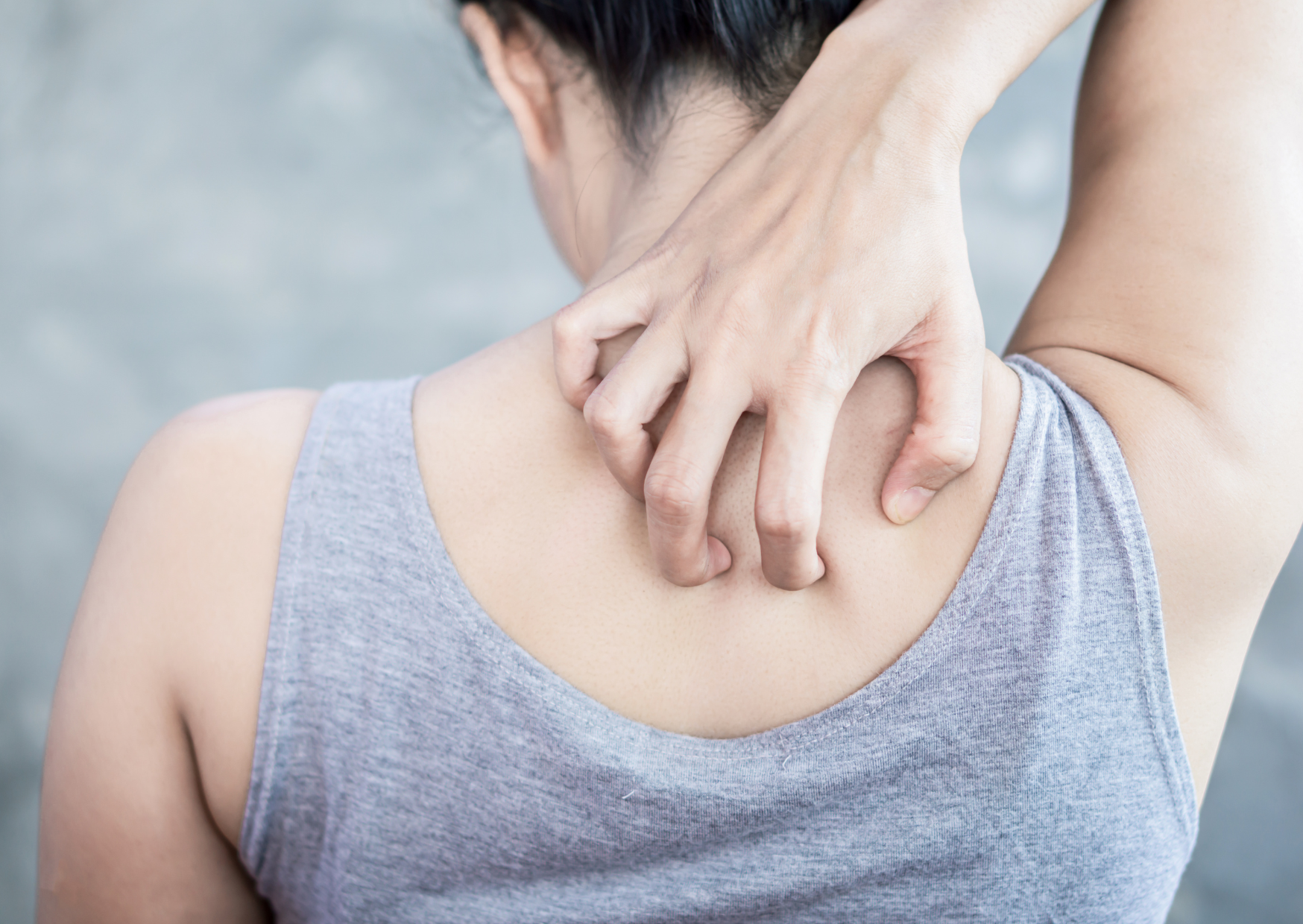 乾燥肌のかゆみがつらい…医師が処方する薬と正しいスキンケアで解決する方法美容薬局®︎オンライン