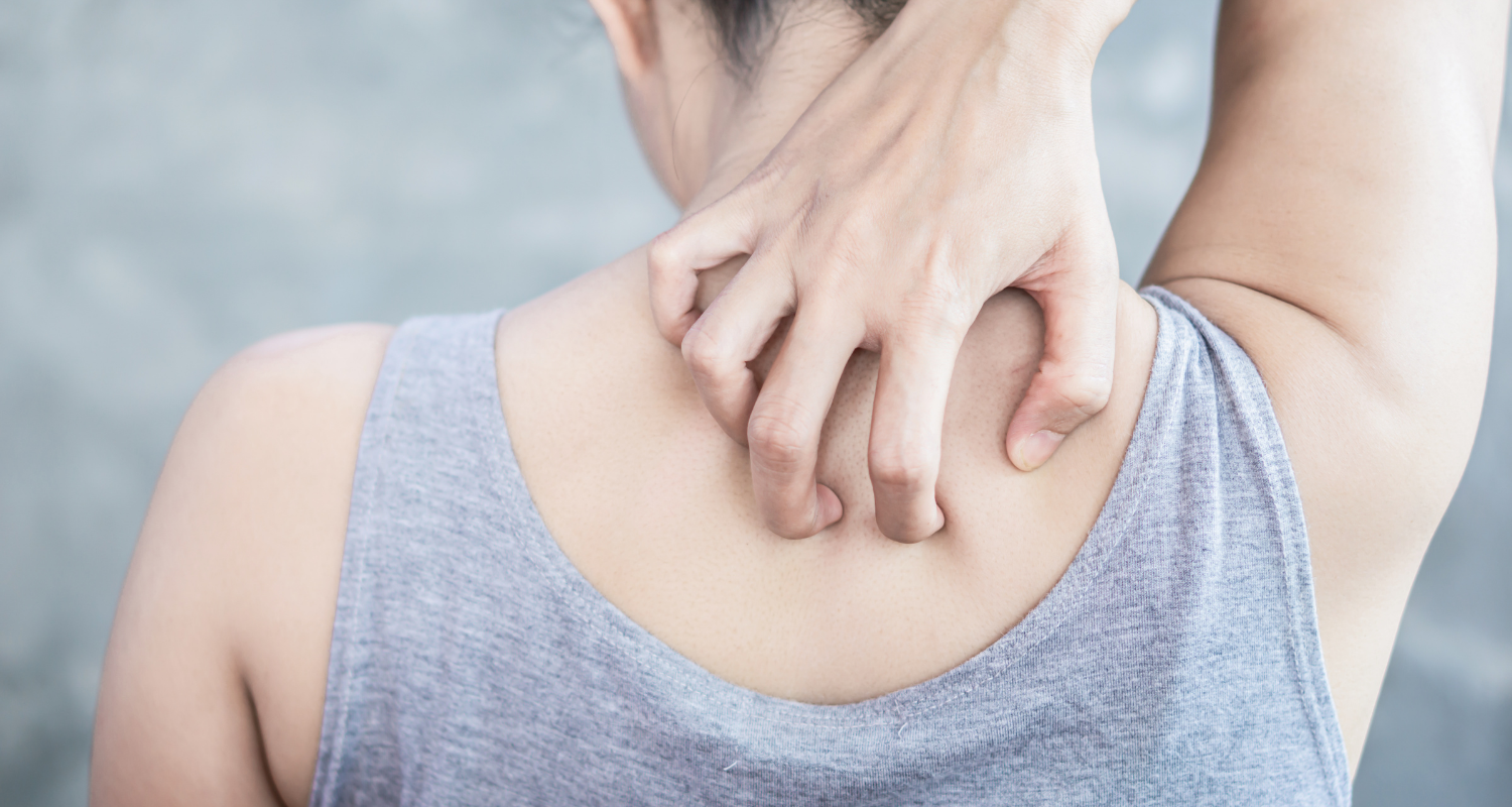 乾燥肌のかゆみがつらい…医師が処方する薬と正しいスキンケアで解決する方法美容薬局®︎オンライン